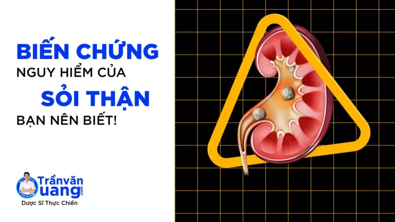 Sỏi thận có nguy hiểm không - biến chứng của sỏi thận là gì?