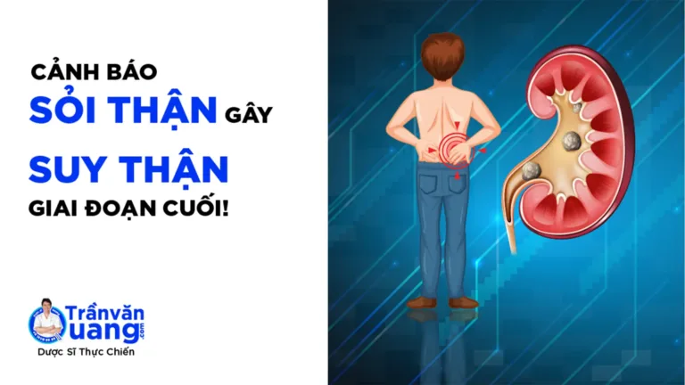 Nguy cơ SUY THẬN GIAI ĐOẠN CUỐI do SỎI TIẾT NIỆU đừng chủ quan!