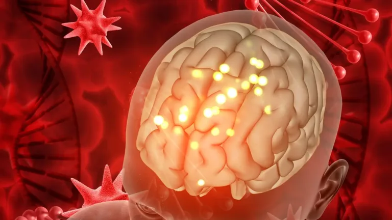 Đột quy: Dấu hiệu nhận biết và phòng ngừa đột quỵ